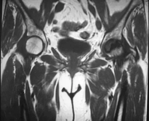 Orthopedic Surgery Board Review 2026 | High-Yield MCQs - Set 1 - Figure 26