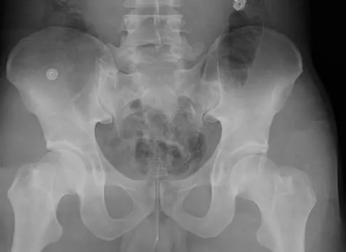 Orthopedic Surgery Board Review 2026 | High-Yield MCQs - Set 1 - Figure 27