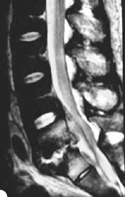 Orthopedic Surgery Board Review 2026 | High-Yield MCQs - Set 1 - Figure 34