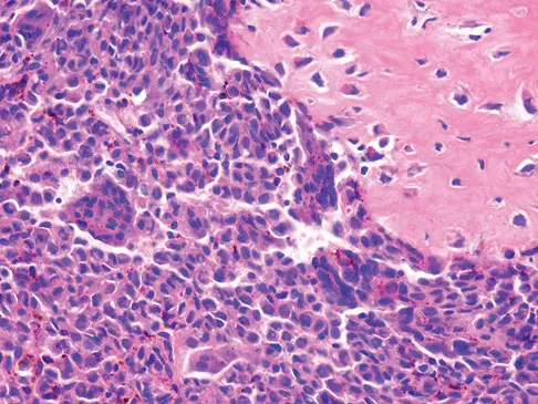 Orthopedic Surgery Board Review 2026 | High-Yield MCQs - Set 1 - Figure 4