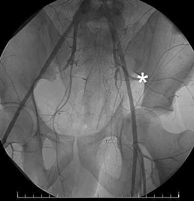 Orthopedic Surgery Board Review 2026 | High-Yield MCQs - Set 1 - Figure 61