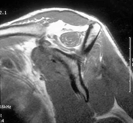 Orthopedic Surgery Board Review 2026 | High-Yield MCQs - Set 1 - Figure 70