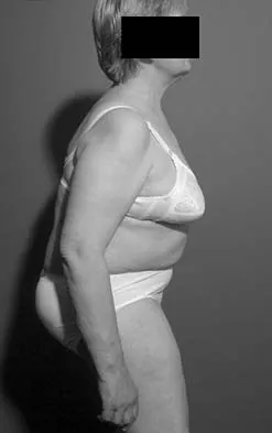 Orthopedic Surgery Board Review 2026 | High-Yield MCQs - Set 1 - Figure 78