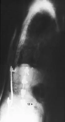 Orthopedic Surgery Board Review 2026 | High-Yield MCQs - Set 1 - Figure 79