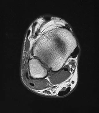 Orthopedic Surgery Board Review 2026 | High-Yield MCQs - Set 1 - Figure 85