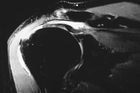 Orthopedic Surgery Board Review 2026 | High-Yield MCQs - Set 1 - Figure 86