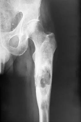 Orthopedic Surgery Board Review 2026 | High-Yield MCQs - Set 1 - Figure 87