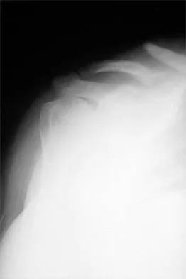 Orthopedic Surgery Board Review 2026 | High-Yield MCQs - Set 1 - Figure 88