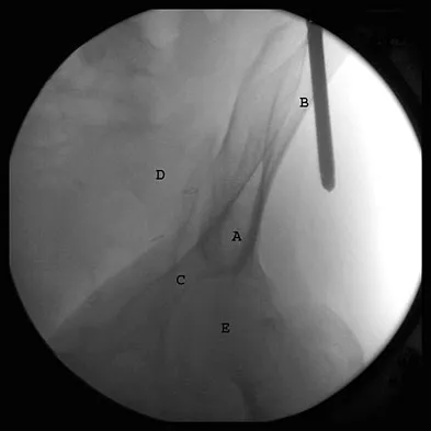 Orthopedic Surgery Board Review 2026 | High-Yield MCQs - Set 10 - Figure 20