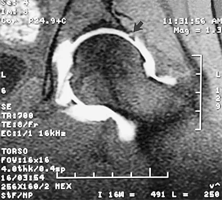 Orthopedic Surgery Board Review 2026 | High-Yield MCQs - Set 10 - Figure 25