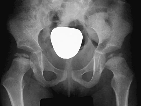 Orthopedic Surgery Board Review 2026 | High-Yield MCQs - Set 10 - Figure 34