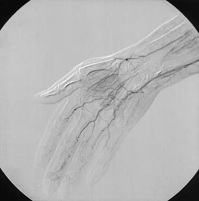 Orthopedic Surgery Board Review 2026 | High-Yield MCQs - Set 10 - Figure 36