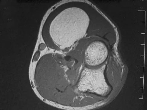 Orthopedic Surgery Board Review 2026 | High-Yield MCQs - Set 10 - Figure 4