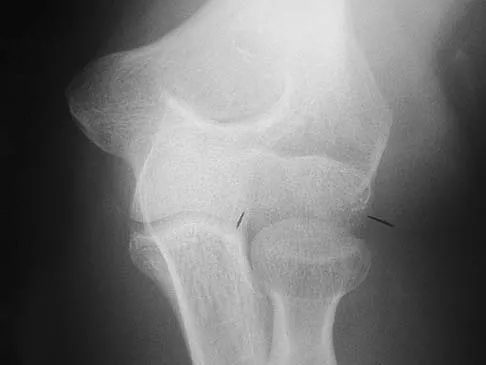 Orthopedic Surgery Board Review 2026 | High-Yield MCQs - Set 10 - Figure 9