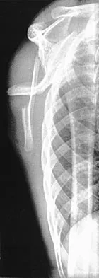 Orthopedic Surgery Board Review 2026 | High-Yield MCQs - Set 2 - Figure 108