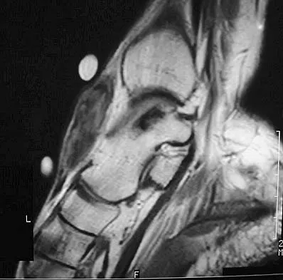 Orthopedic Surgery Board Review 2026 | High-Yield MCQs - Set 2 - Figure 37