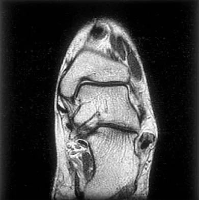 Orthopedic Surgery Board Review 2026 | High-Yield MCQs - Set 2 - Figure 71