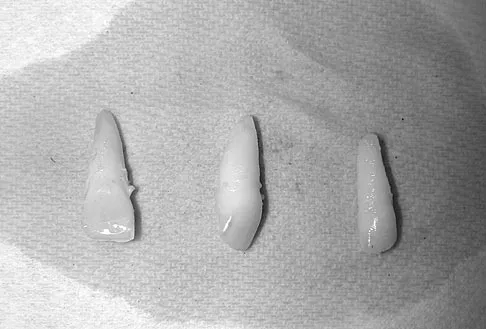 Orthopedic Surgery Board Review 2026 | High-Yield MCQs - Set 2 - Figure 87