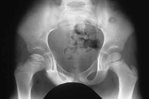 Orthopedic Surgery Board Review 2026 | High-Yield MCQs - Set 2 - Figure 89