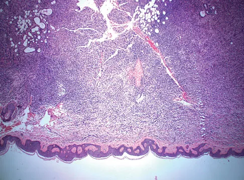 Orthopedic Surgery Board Review 2026 | High-Yield MCQs - Set 2 - Figure 95
