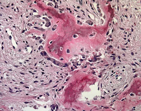 Orthopedic Surgery Board Review 2026 | High-Yield MCQs - Set 2 - Figure 99