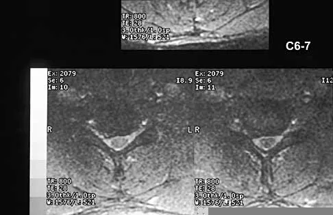 Orthopedic Surgery Board Review 2026 | High-Yield MCQs - Set 3 Figure 1