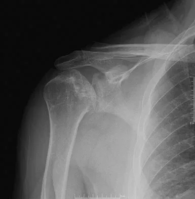 Orthopedic Surgery Board Review 2026 | High-Yield MCQs - Set 3 - Figure 11