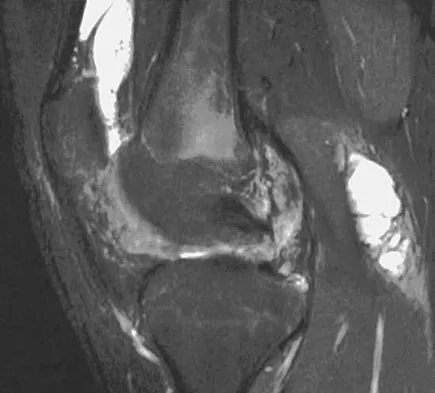 Orthopedic Surgery Board Review 2026 | High-Yield MCQs - Set 3 - Figure 13