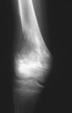 Orthopedic Surgery Board Review 2026 | High-Yield MCQs - Set 3 - Figure 23