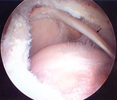 Orthopedic Surgery Board Review 2026 | High-Yield MCQs - Set 3 - Figure 26