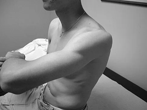 Orthopedic Surgery Board Review 2026 | High-Yield MCQs - Set 3 - Figure 27