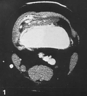 Orthopedic Surgery Board Review 2026 | High-Yield MCQs - Set 3 - Figure 35