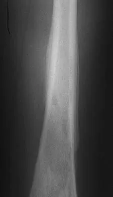 Orthopedic Surgery Board Review 2026 | High-Yield MCQs - Set 3 - Figure 4