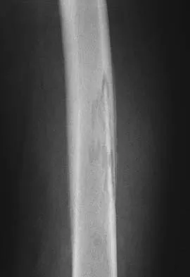 Orthopedic Surgery Board Review 2026 | High-Yield MCQs - Set 3 - Figure 5