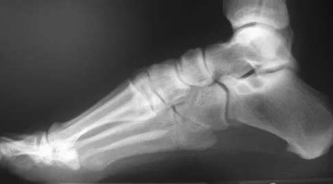 Orthopedic Surgery Board Review 2026 | High-Yield MCQs - Set 3 - Figure 67