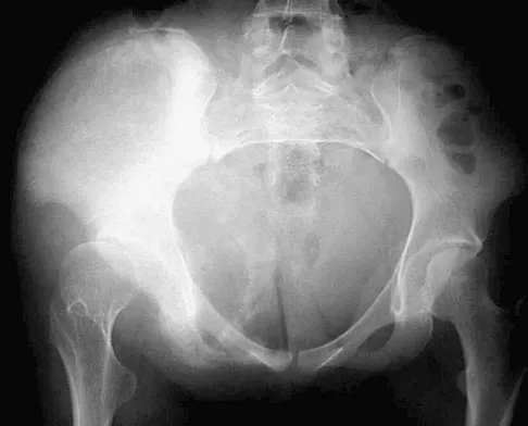 Orthopedic Surgery Board Review 2026 | High-Yield MCQs - Set 3 - Figure 7