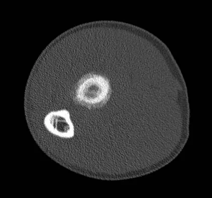 Orthopedic Surgery Board Review 2026 | High-Yield MCQs - Set 3 - Figure 77