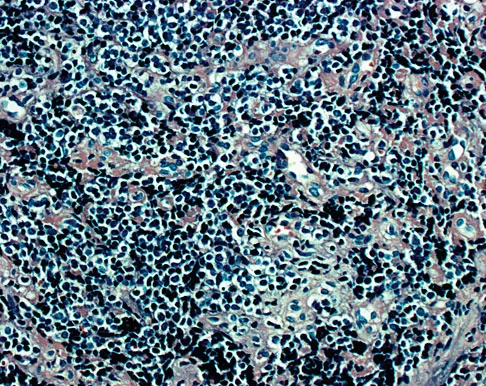 Orthopedic Surgery Board Review 2026 | High-Yield MCQs - Set 3 - Figure 80