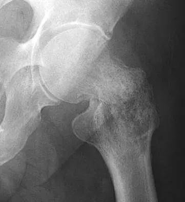 Orthopedic Surgery Board Review 2026 | High-Yield MCQs - Set 3 - Figure 84