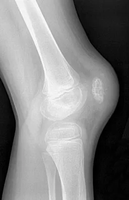 Orthopedic Surgery Board Review 2026 | High-Yield MCQs - Set 3 - Figure 88