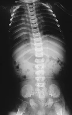 Orthopedic Surgery Board Review 2026 | High-Yield MCQs - Set 4 - Figure 125