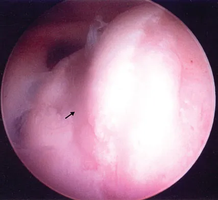 Orthopedic Surgery Board Review 2026 | High-Yield MCQs - Set 4 - Figure 20