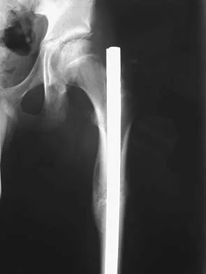 Orthopedic Surgery Board Review 2026 | High-Yield MCQs - Set 4 - Figure 29