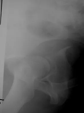 Orthopedic Surgery Board Review 2026 | High-Yield MCQs - Set 4 - Figure 33