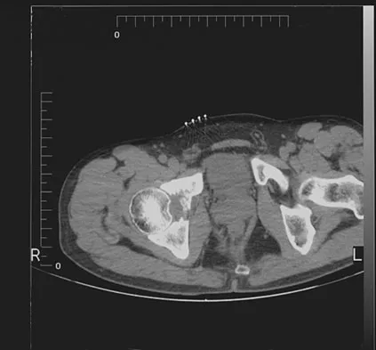 Orthopedic Surgery Board Review 2026 | High-Yield MCQs - Set 4 - Figure 47