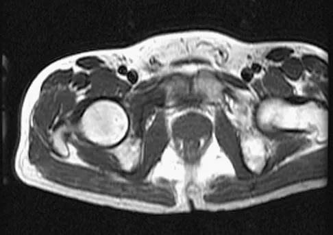 Orthopedic Surgery Board Review 2026 | High-Yield MCQs - Set 4 - Figure 48