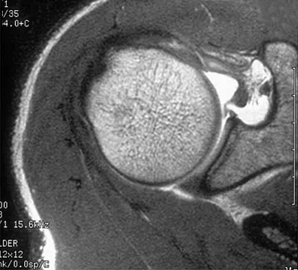 Orthopedic Surgery Board Review 2026 | High-Yield MCQs - Set 4 - Figure 5
