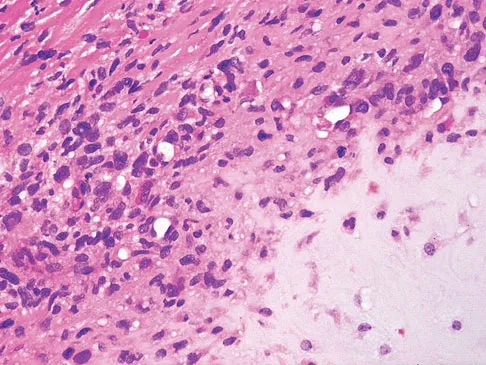 Orthopedic Surgery Board Review 2026 | High-Yield MCQs - Set 4 - Figure 51