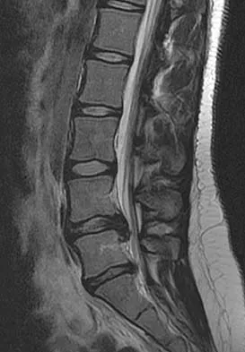 Orthopedic Surgery Board Review 2026 | High-Yield MCQs - Set 4 - Figure 52