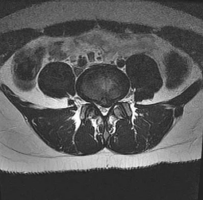 Orthopedic Surgery Board Review 2026 | High-Yield MCQs - Set 4 - Figure 53